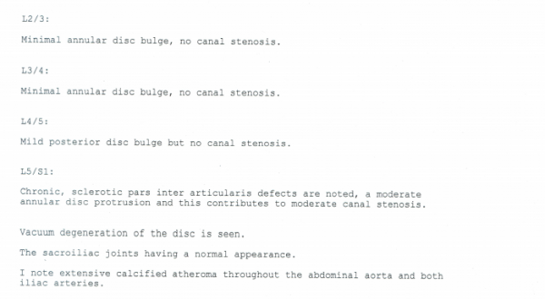 Page of a lumbar spine scan report listing disc bulges and canal stenosis level by level