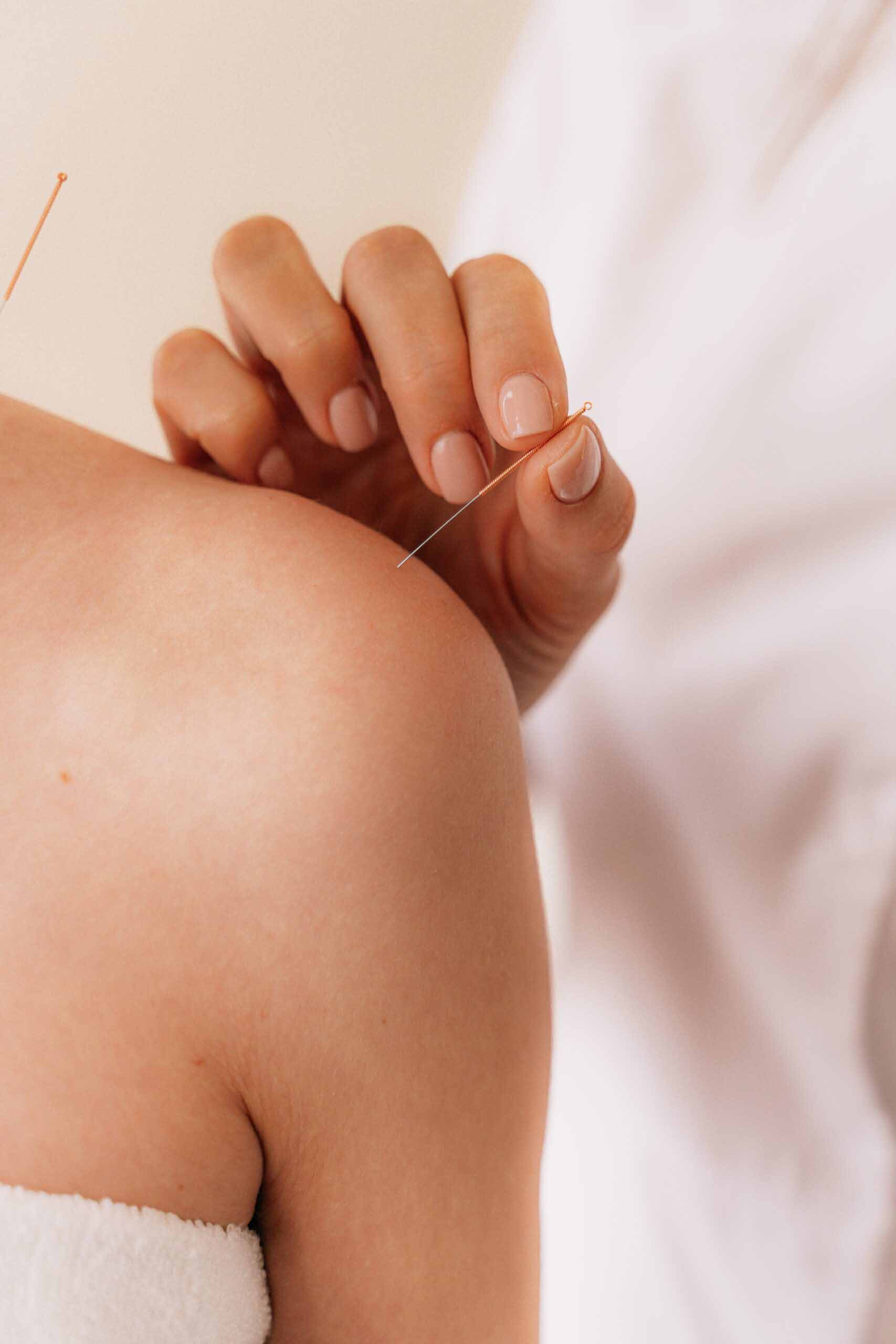 allforone - acupuncture-near-me