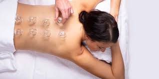 allforone - cupping-therapy-yarraville