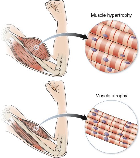 allforone - hypertrophy