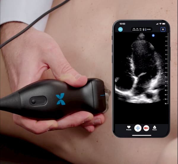 Real-time ultrasound pelvic floor assessment